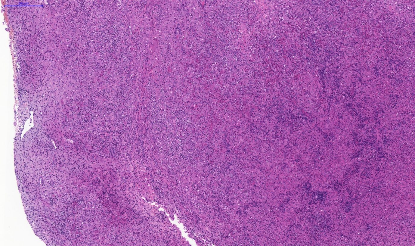 Fig. 2. Nasal tissue, feline. Severe pyogranulomatous inflammation