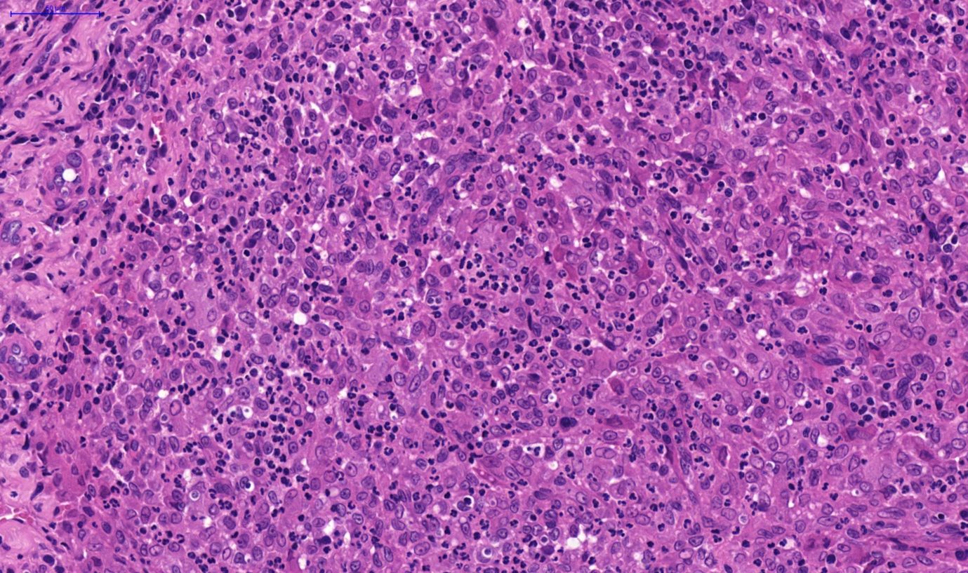Fig. 3. Nasal tissue, feline. Severe pyogranulomatous inflammation