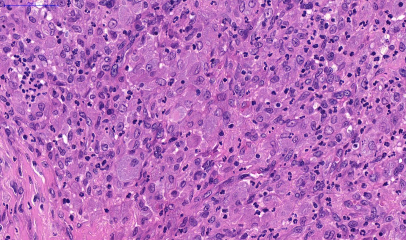 Fig. 4. Nasal tissue, feline. Severe pyogranulomatous inflammation