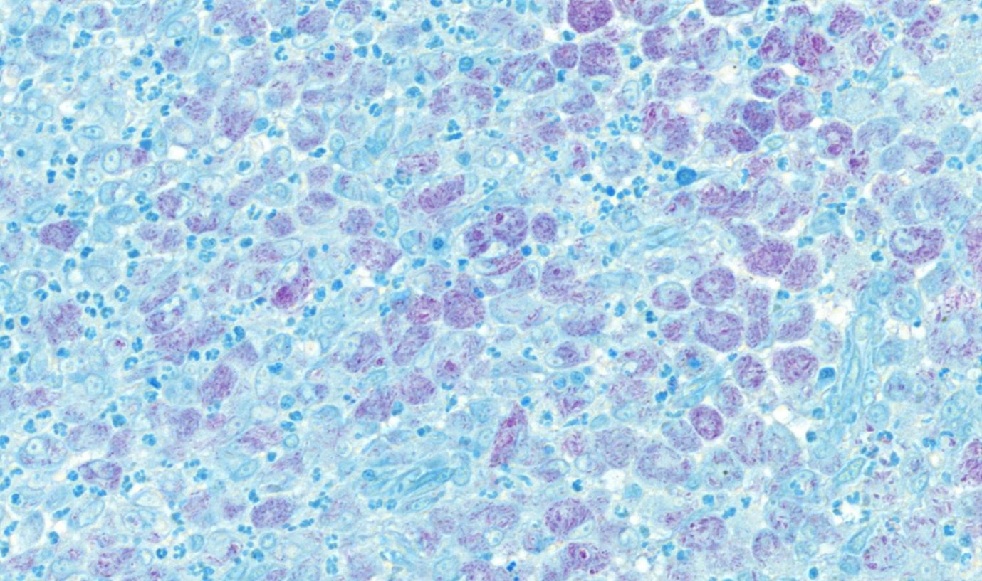 Fig. 5. Nasal tissue, feline. Nasal tissue showing intracytoplasmic acid fast rods within macrophages