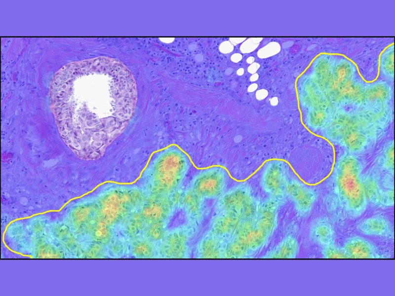 Indica Labs Sets New Standard for Molecular Testing in Breast Cancer with Expansion of AI Macrodissection Portfolio (1)