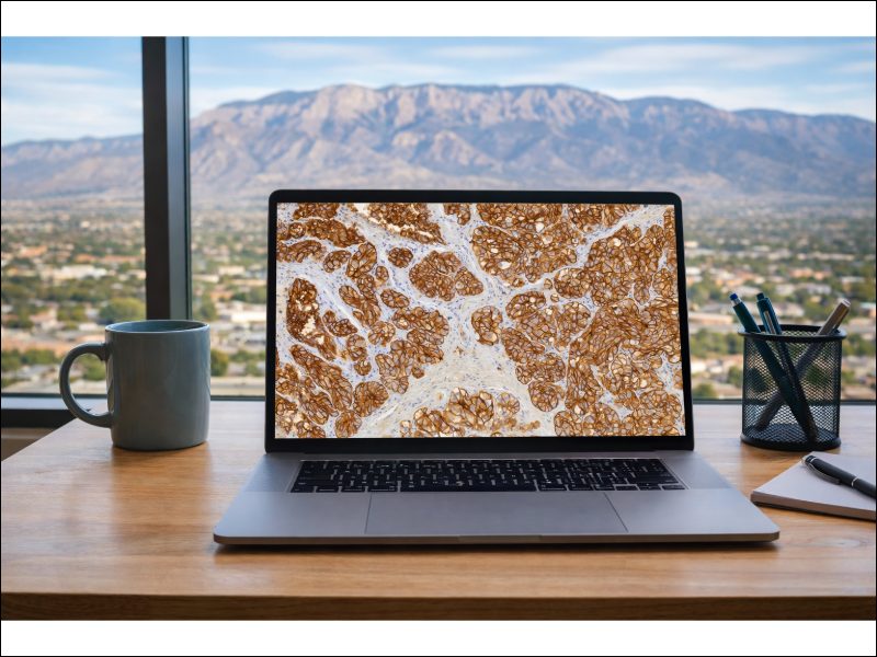 AI and Digital Pathology in Personalized Medicine The Past, Present, and Future of Breast Cancer Care