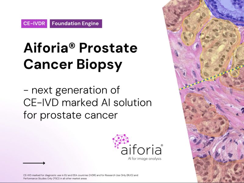 Aiforia Announces the Next Generation of Its CE IVD Marked Prostate Cancer Biopsy AI Solution