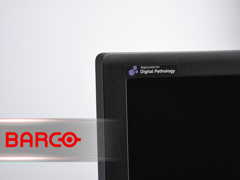 Barco Selected as Exclusive Partner by MUSE Microscopy for Its SmartPath Direct to digital Tissue Imaging System