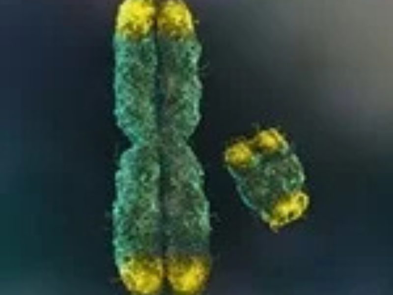 Computational Model Predicts Telomere Length from Biopsy Images
