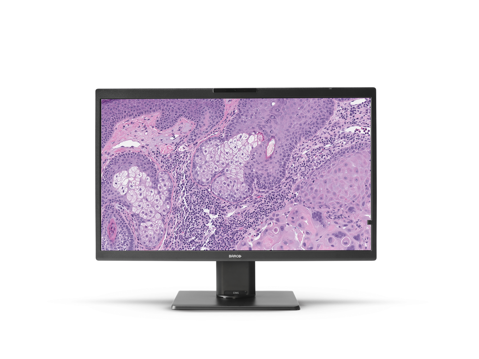 Eonis front transp pathology01