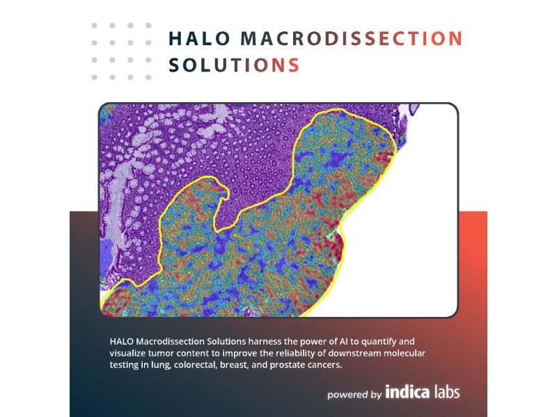 Indica Labs’ HALO Macrodissection Solutions