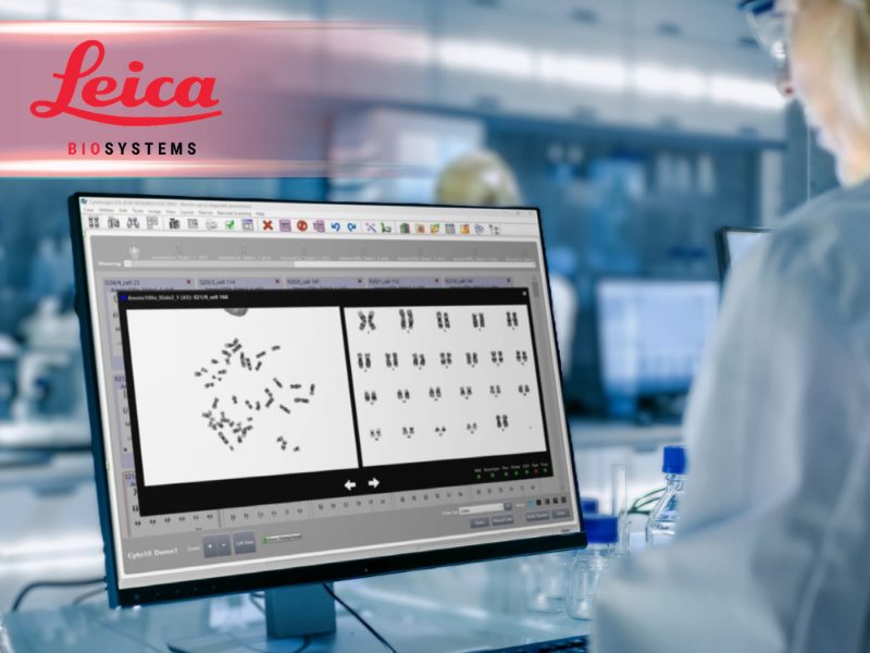 Leica Biosystems Elevates Cytogenetics with AI Powered Karyotyping on the CytoInsight GSL Platform