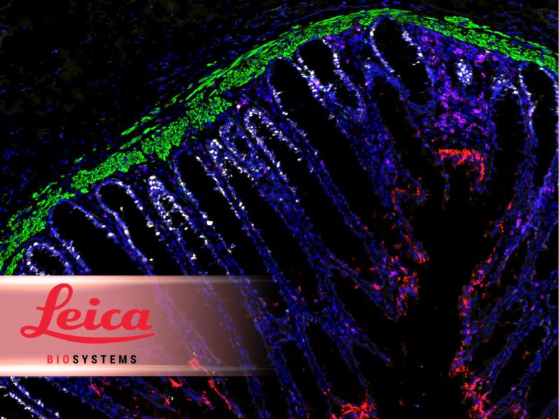 Leica Biosystems Launches a 4 Plex Fluorescent Detection Kit to Advance Cancer Research