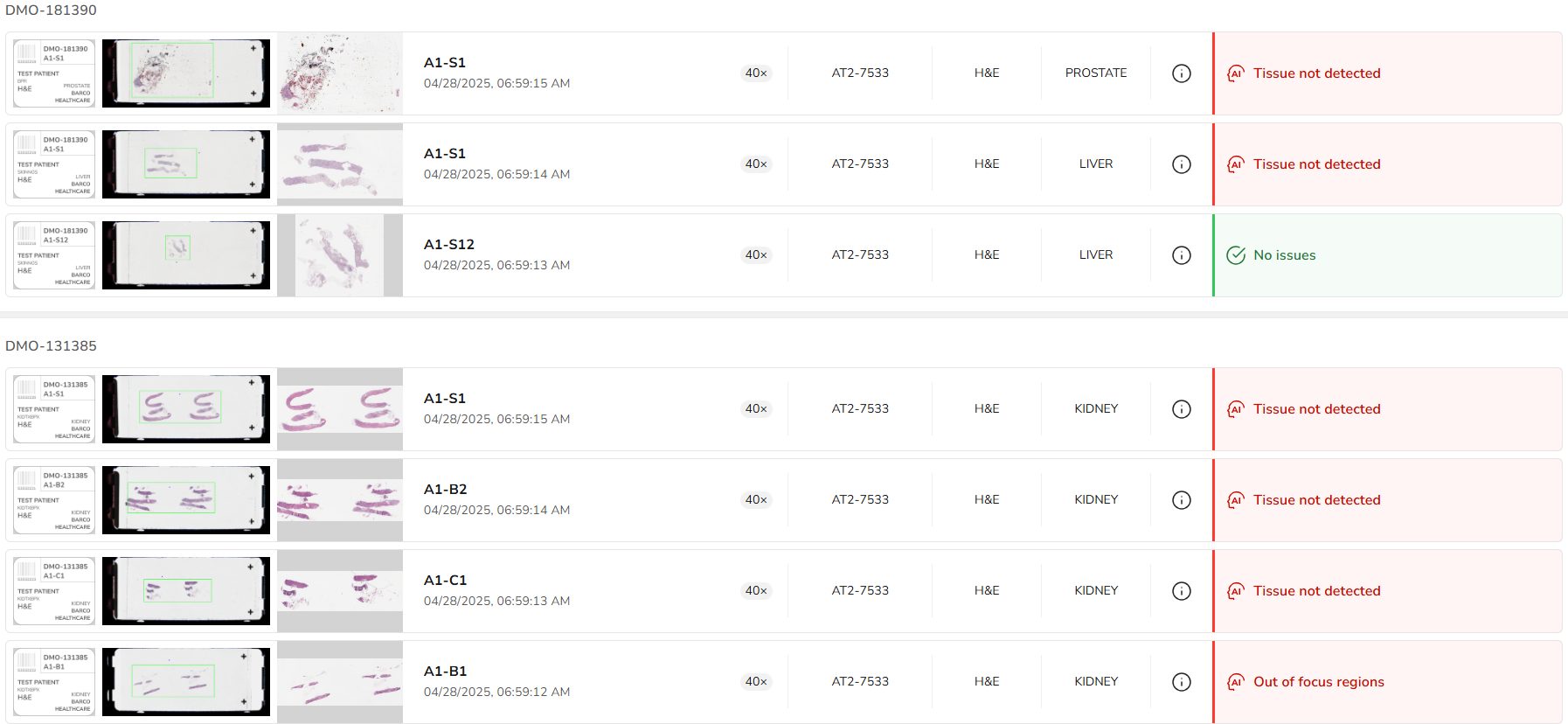 List view