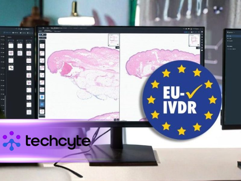 Techcyte Achieves CE Marking Under IVDR for Fusion AP Digital Pathology Platform