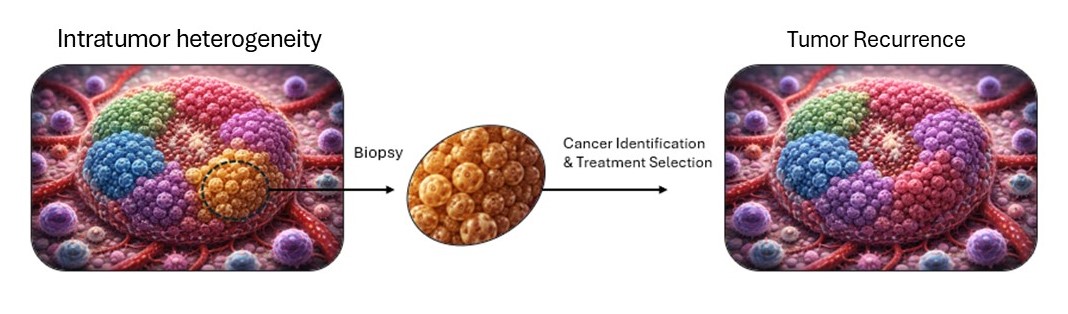 Tumor rec