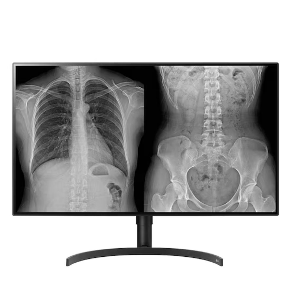 31.5 LG 8MP Diagnostic Monitor