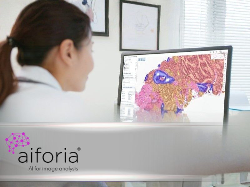 Aiforia Has Been Selected as an AI Partner for the PROSTIA Project – Expands to Five New Hospitals in Paris