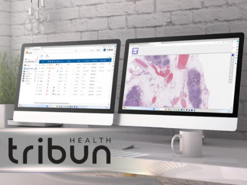 CaloPix Connect An Open API to Integrate AI into the Digital Pathology Workflow