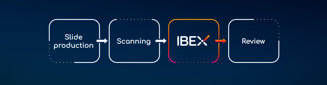 Ibex workflow Ibex workflow
