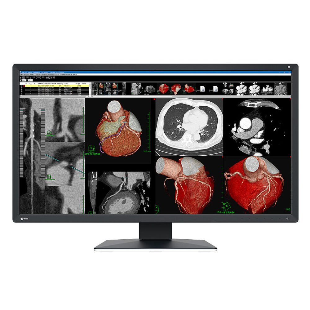 MX317W RadiForce