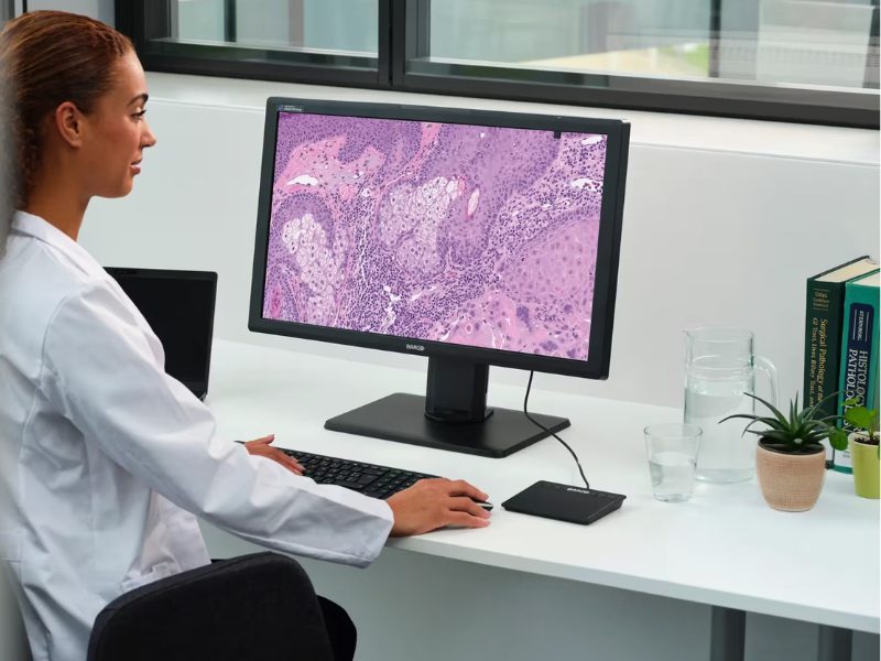 Aligning Display Expectations in Digital Pathology Research Insights, Tips and Tricks