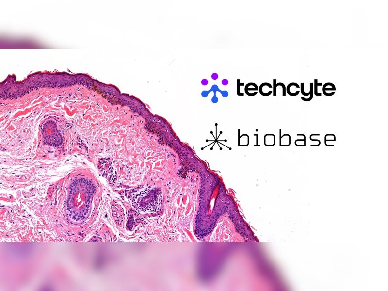 Biobase and Techcyte Partner to Advance Digital Pathology and Unlock the Full Potential of Clinical Data