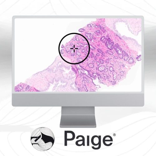 Paige Prostate
