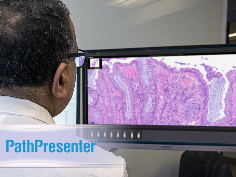 Success Story Expanding Access to Expert Cancer Diagnostics Through Digital Pathology Consultations