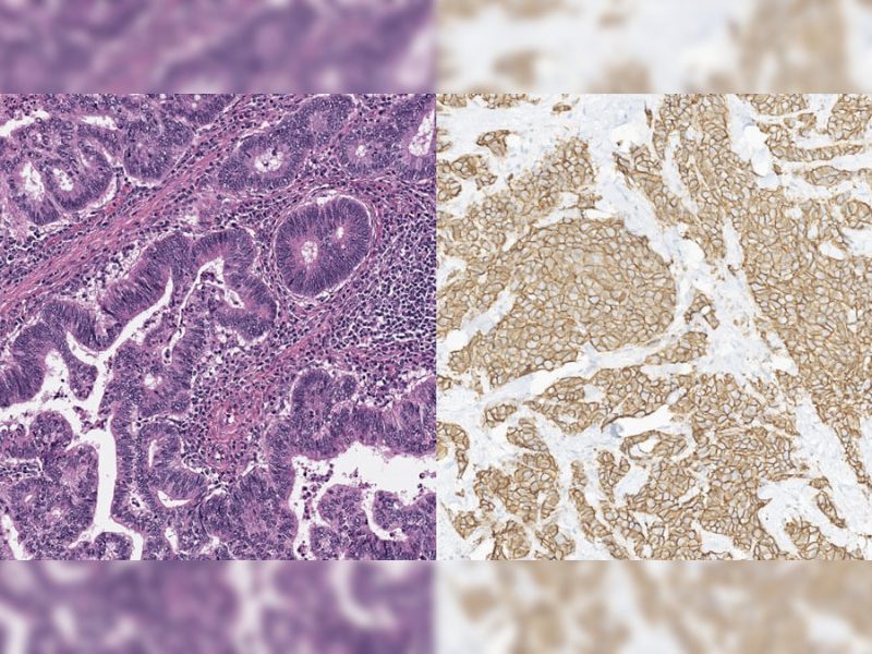 Waiv Enters Collaboration with Daiichi Sankyo to Deliver AI Derived Biomarkers for ADC Program