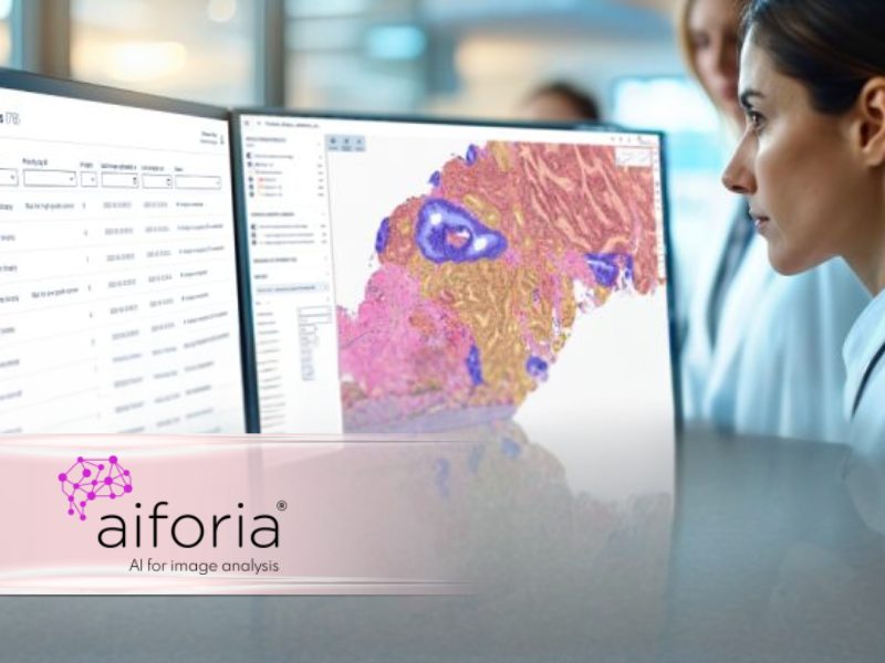 Aiforia Expands Its Presence in Spain Through a New Clinical Account