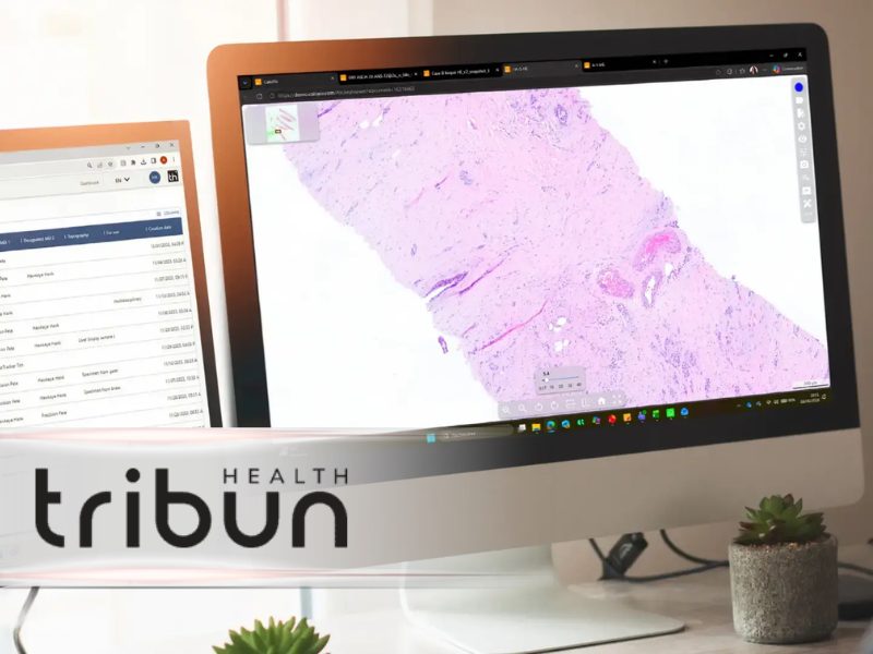 Why Digital Pathology Adoption Depends on Governance and Operations
