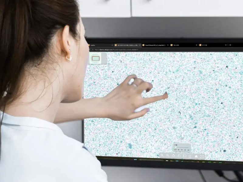5 Operational KPIs to Monitor Digital Pathology Adoption