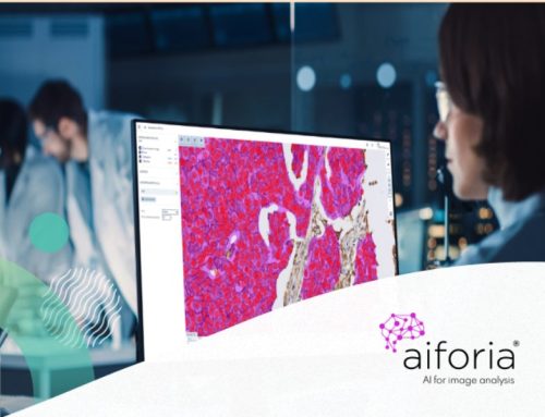 Aiforia Brings AI-assisted Lung Cancer Analysis to NHS Pathology Workflows