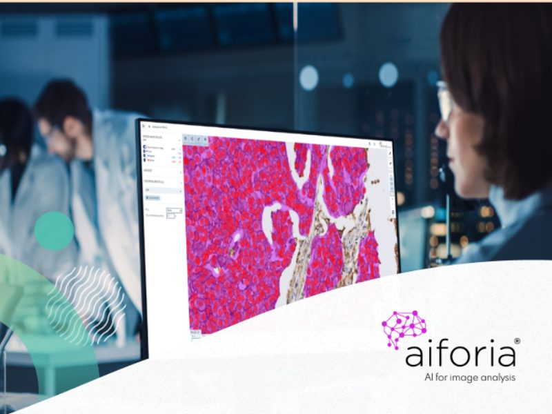 Aiforia Brings AI assisted Lung Cancer Analysis to NHS Pathology Workflows