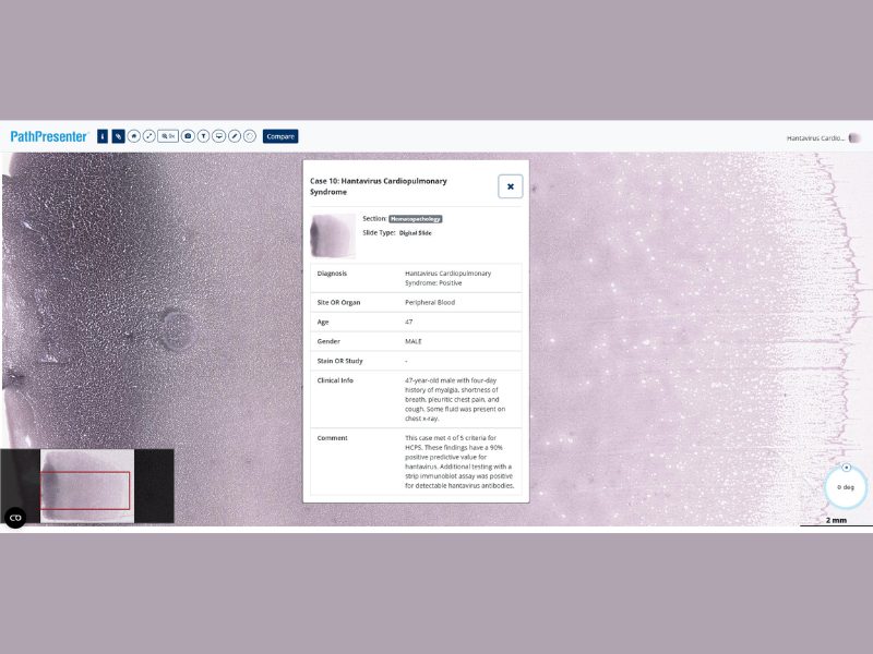 Expanding Access to Hantavirus Education Sharing Images Through the PathPresenter Public Library