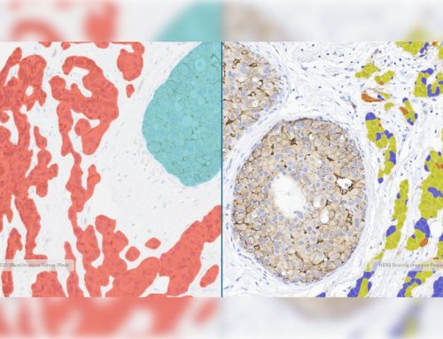 Indica Labs Advances Breast Cancer AI with Zero-Click Tissue Classification Prior to Biomarker Analysis