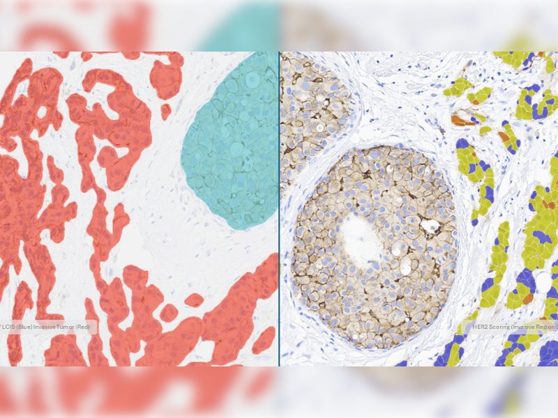 Indica Labs Advances Breast Cancer AI with Zero-Click Tissue Classification Prior to Biomarker Analysis