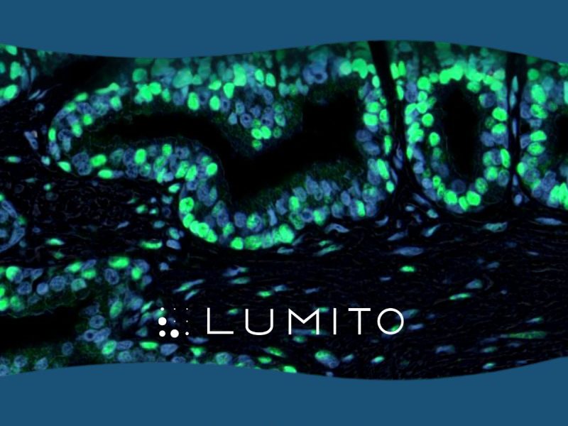 Lumito Reports Positive Results from Ongoing Collaborative Research Projects – SCIZYS Demonstrates High Sensitivity Across Multiple Applications