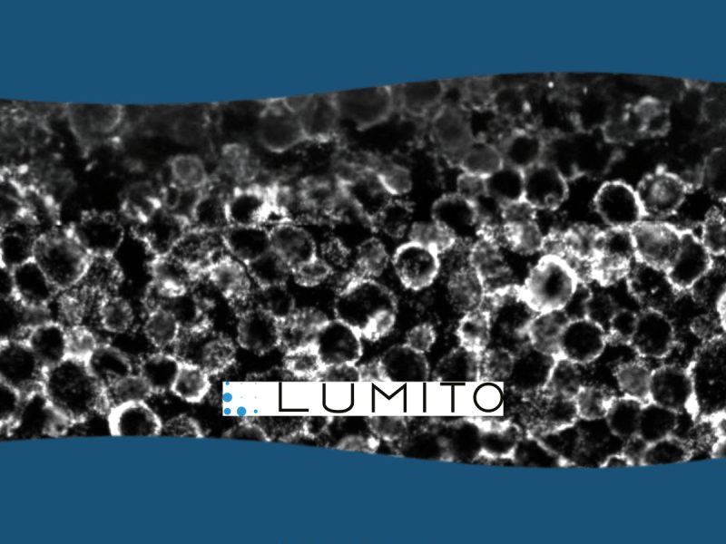 Lumito and Offspring Biosciences Report Promising Initial Results from Pilot Study Evaluating Automated Immunohistochemistry Platform