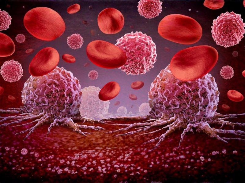 Study Reveals How Leukemia Cells Enter and Damage Lungs (1)