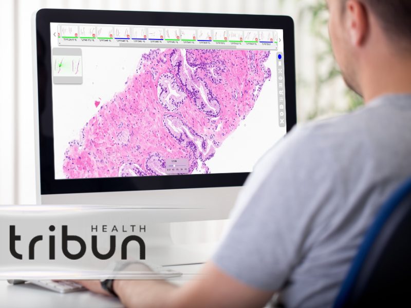 Tribun Health Announces CaloPix® 6, Its First IVDR Certified Version for Routine Diagnostic Use