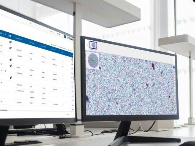 Tribun Health Supports CGI’s Vendor of Record Selection Across All Four Mohawk Medbuy Digital Pathology Software Categories