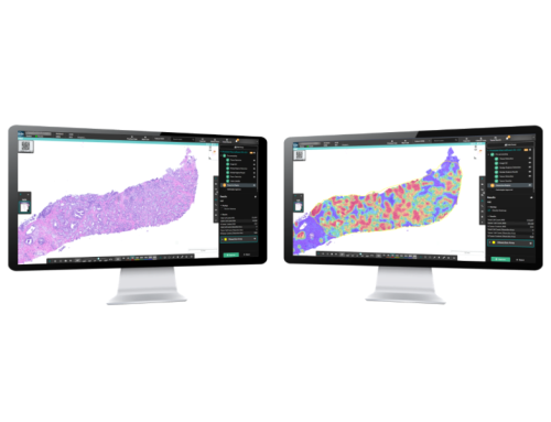 Indica Labs Expands into Prostate Cancer, Improving NGS Confidence Through Precise Tumor Quantification
