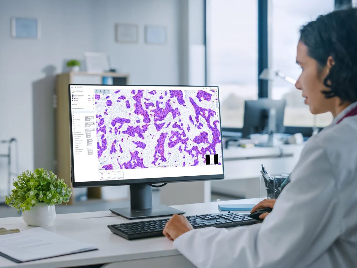 See how Fimlab integrated Aiforia, Philips and Software Point to streamline breast cancer diagnostics through an interoperable digital pathology workflow.