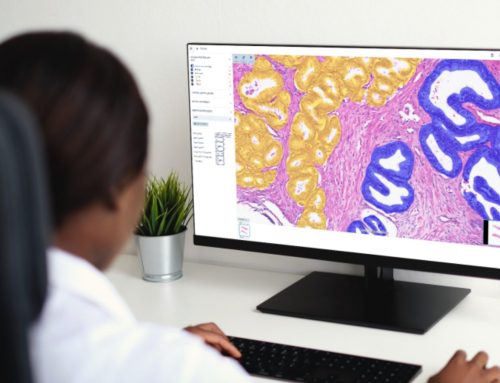Aiforia Lands EU Financing to Develop AI-powered Cancer Detection