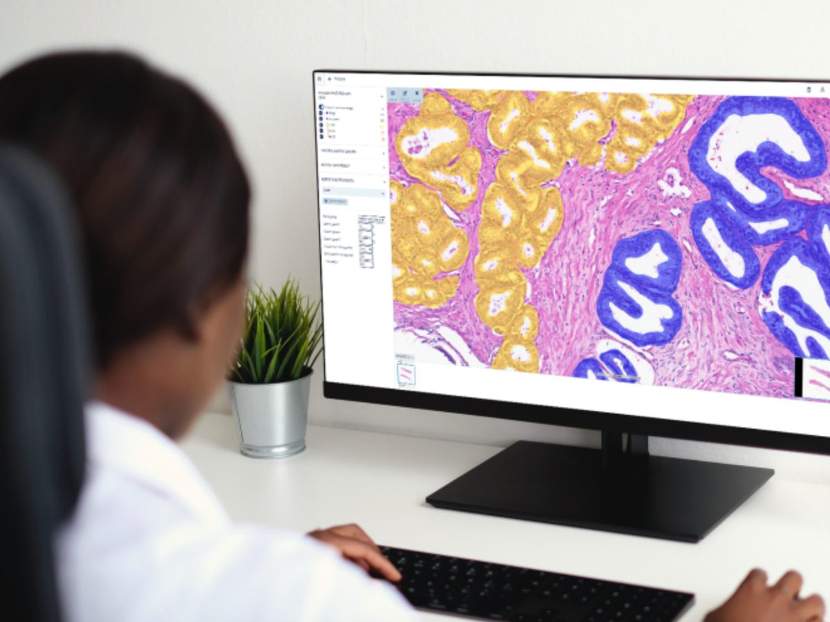 Aiforia has secured €20 million in EIB venture debt financing to accelerate development and global growth of its AI-powered digital pathology platform.