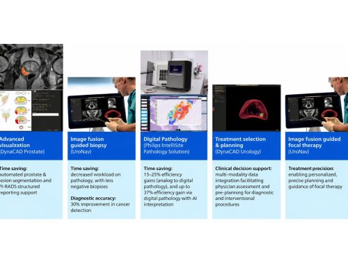 Integrated prostate cancer care: efficiency, accuracy, and confidence at every stage
