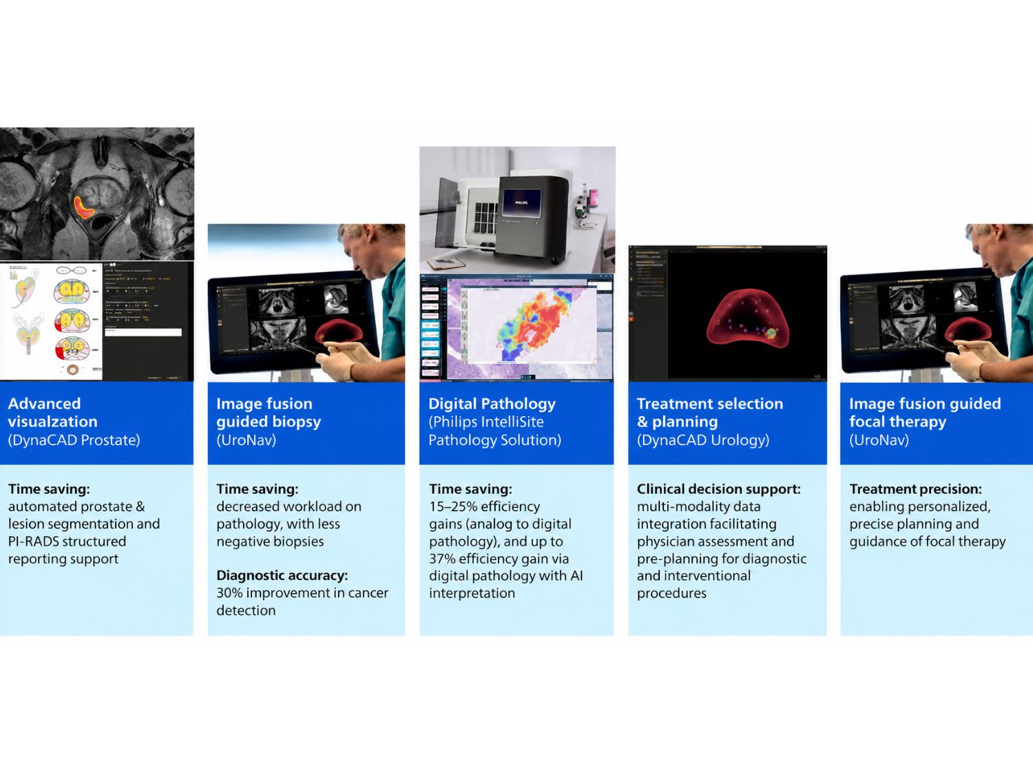 Integrated prostate cancer care: efficiency, accuracy, and confidence at every stage