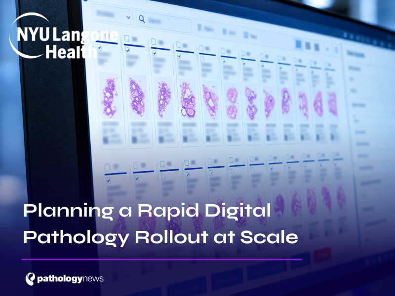 Planning a Rapid Digital Pathology Rollout at Scale