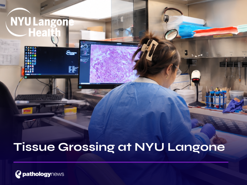 Tissue Grossing at NYU Langone
