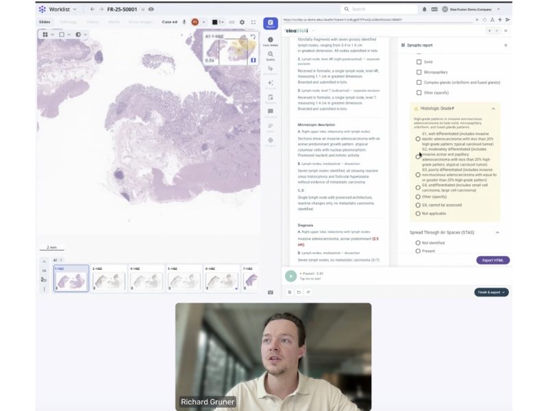 “Don’t dictate. Direct.” eleaDNAi shown live inside Techcyte Fusion AP in joint webinar image