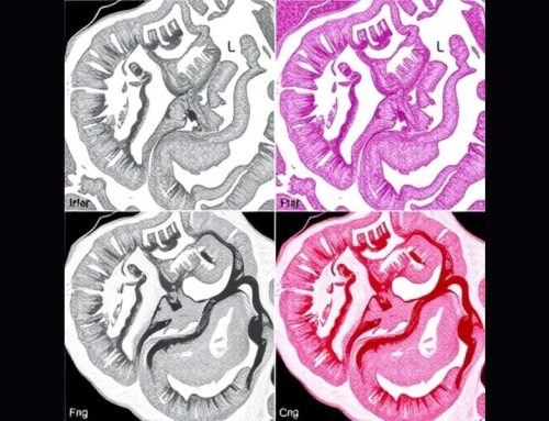 Enhanced INFO algorithm enables multi-threshold segmentation of colorectal cancer histopathology images