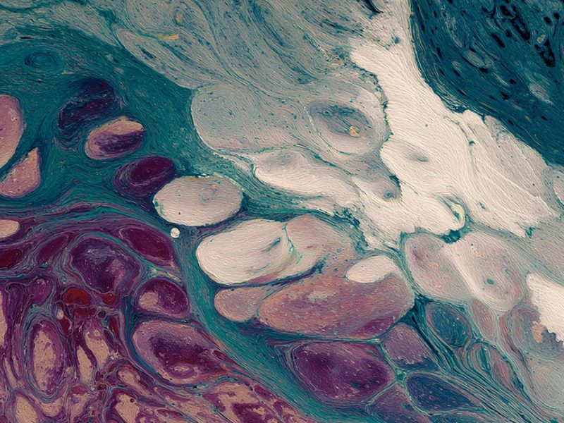 Freedom to Grow Why an Open, Interoperable Platform Is Non Negotiable for Digital Pathology